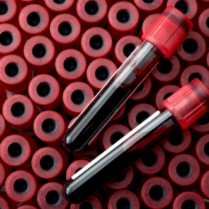Blood Chemistry