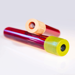 Baseline Hormone Profile