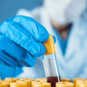 Comprehensive Metabolic Panel