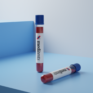 Anti Mullerian Hormone (AMH)