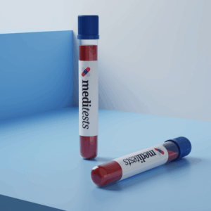 Iron Studies Blood Test