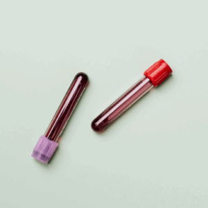 Progesterone Blood Test